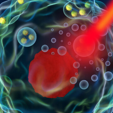 Σύνδρομο Post-Covid | Πιθανά θετικά αποτελέσματα από τη θεραπεία ολικής υπερθερμίας